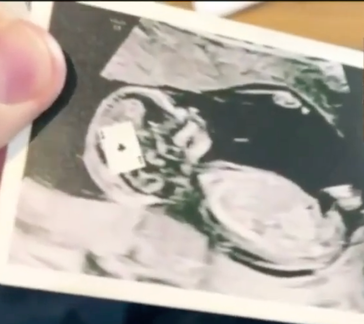 Ultrasound By Iain Bailey Magic